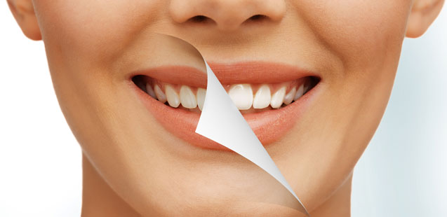 Стоматология – отбеливание зубов