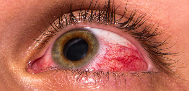 На сколько опасно хирургическое лечение глаукомы?