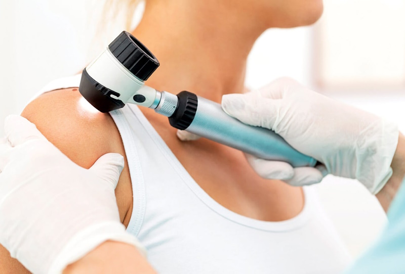 Консультация дерматолога